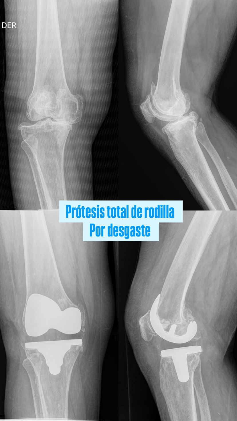 Juan Pablo Torres Nilo-2