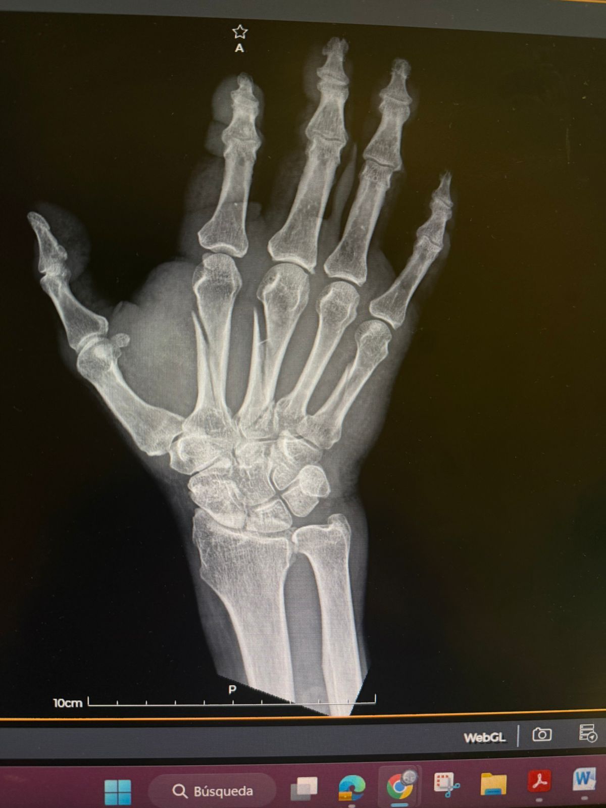 Alejandro Irisson-26