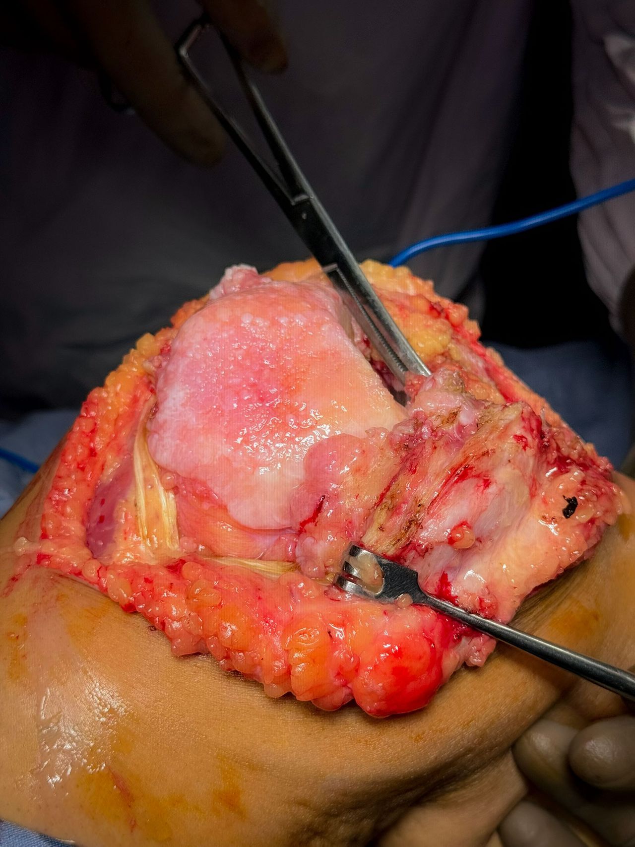 Mario Alberto Lopez Medina-16