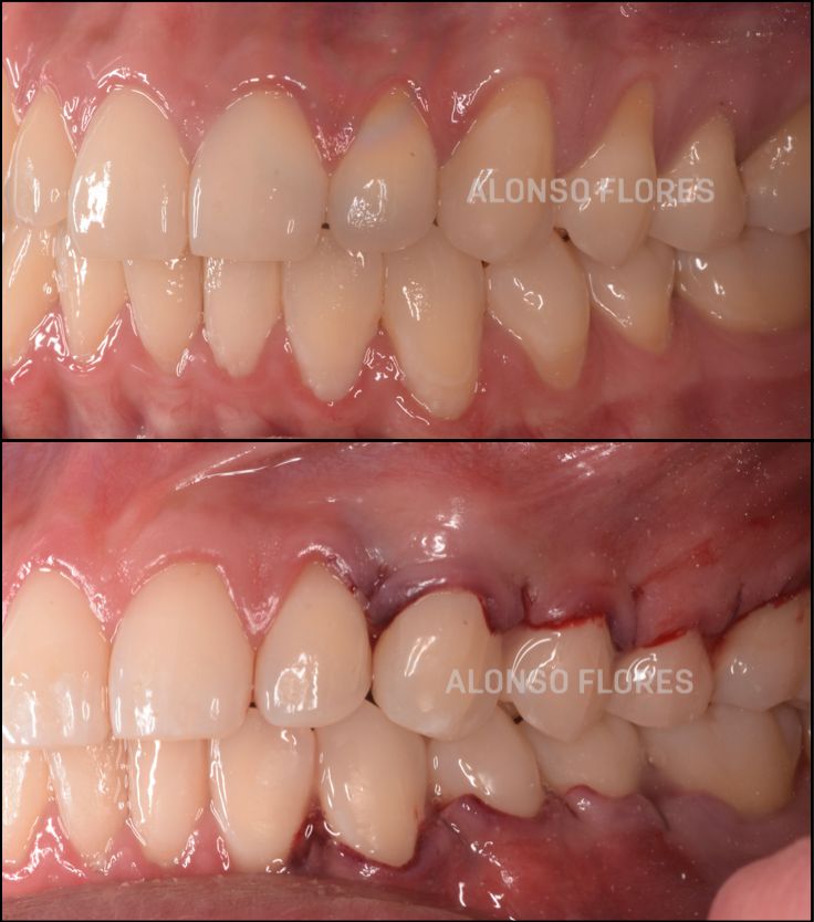 Luis Alonso Flores Reyna-6