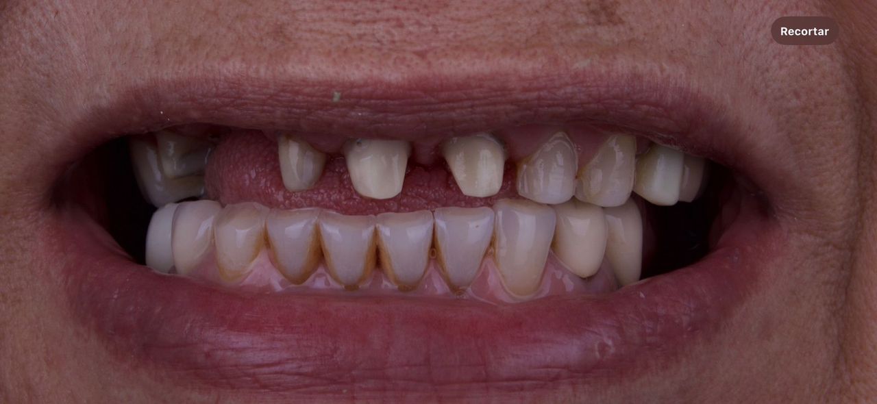 Jesús Israel López Casas-8