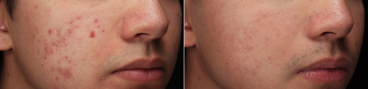 Lauro Francisco Varela Coronado-10