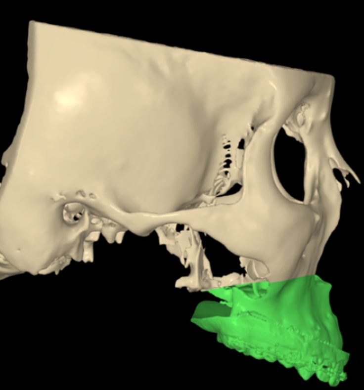 Luis Enrique Cruz Hernández-44