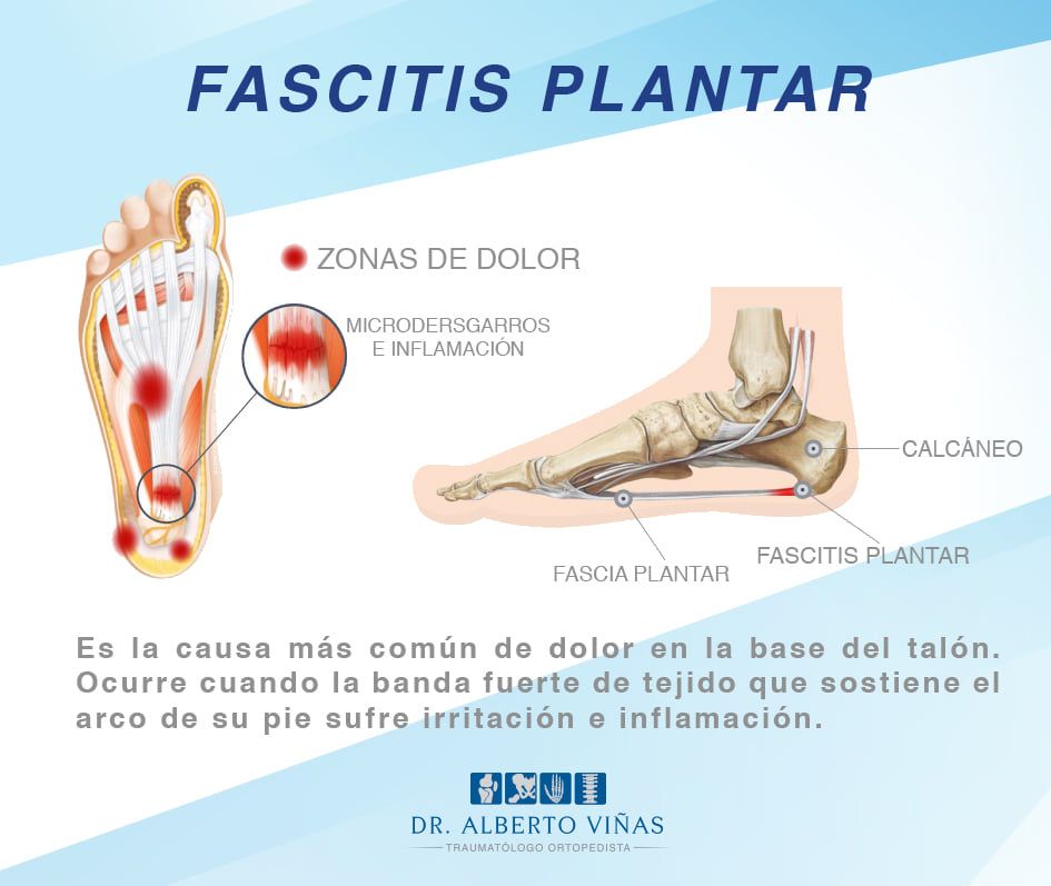 Alberto Viñas Silva-30
