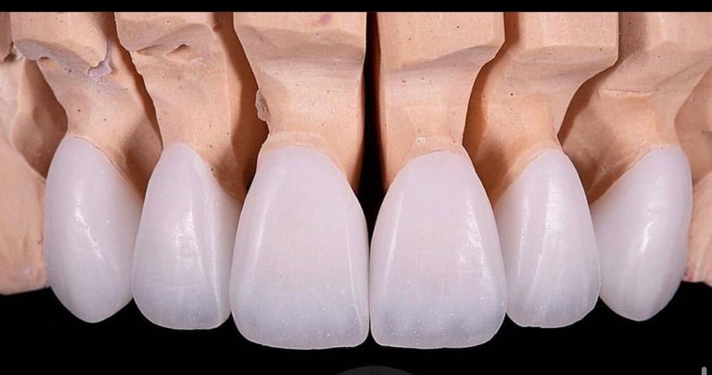 Arturo Mendez Valencia-8