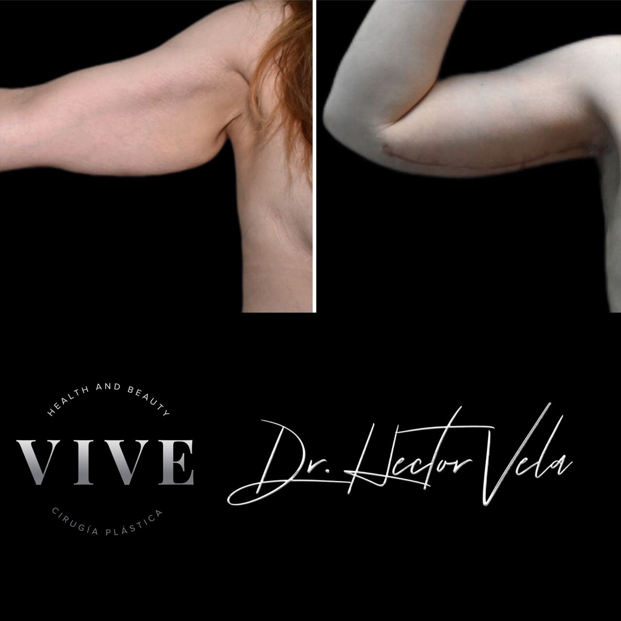 Héctor Eduardo Vela Cardona-248