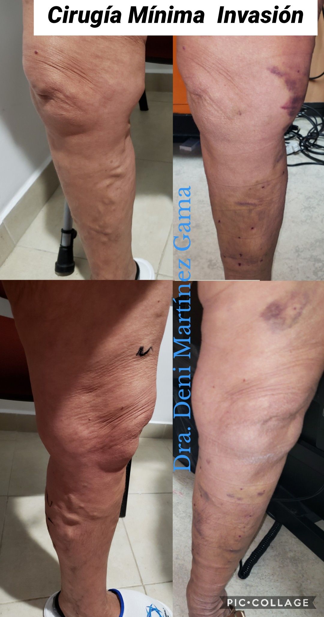 Deni Martínez Gama-13