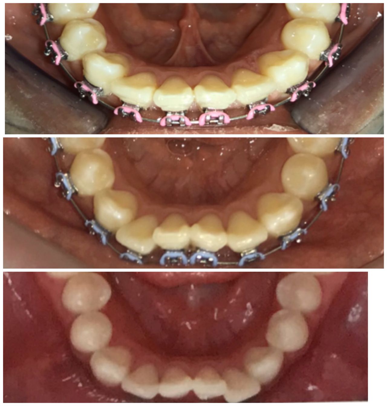 Zuriel Ayala Garcia-14