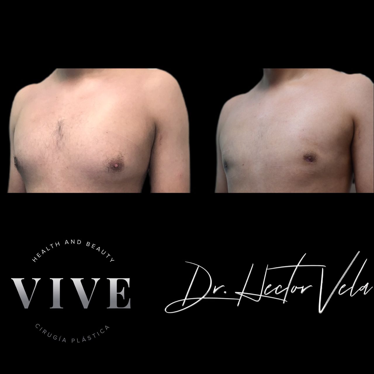 Héctor Eduardo Vela Cardona-232