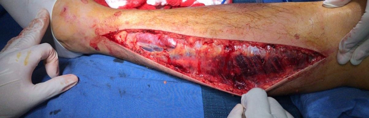 Gilberto Hernández Ortega-40