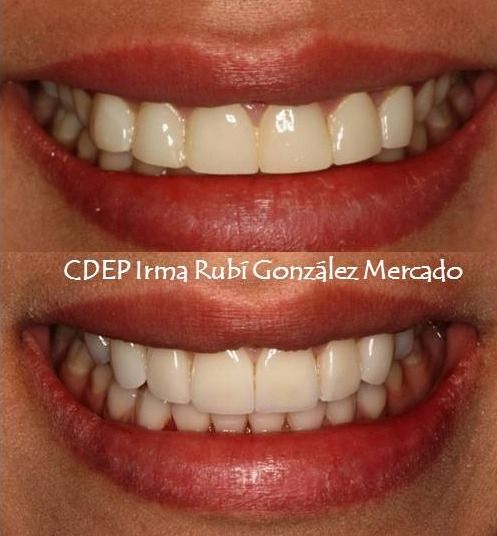 Irma Rubí González Mercado-1
