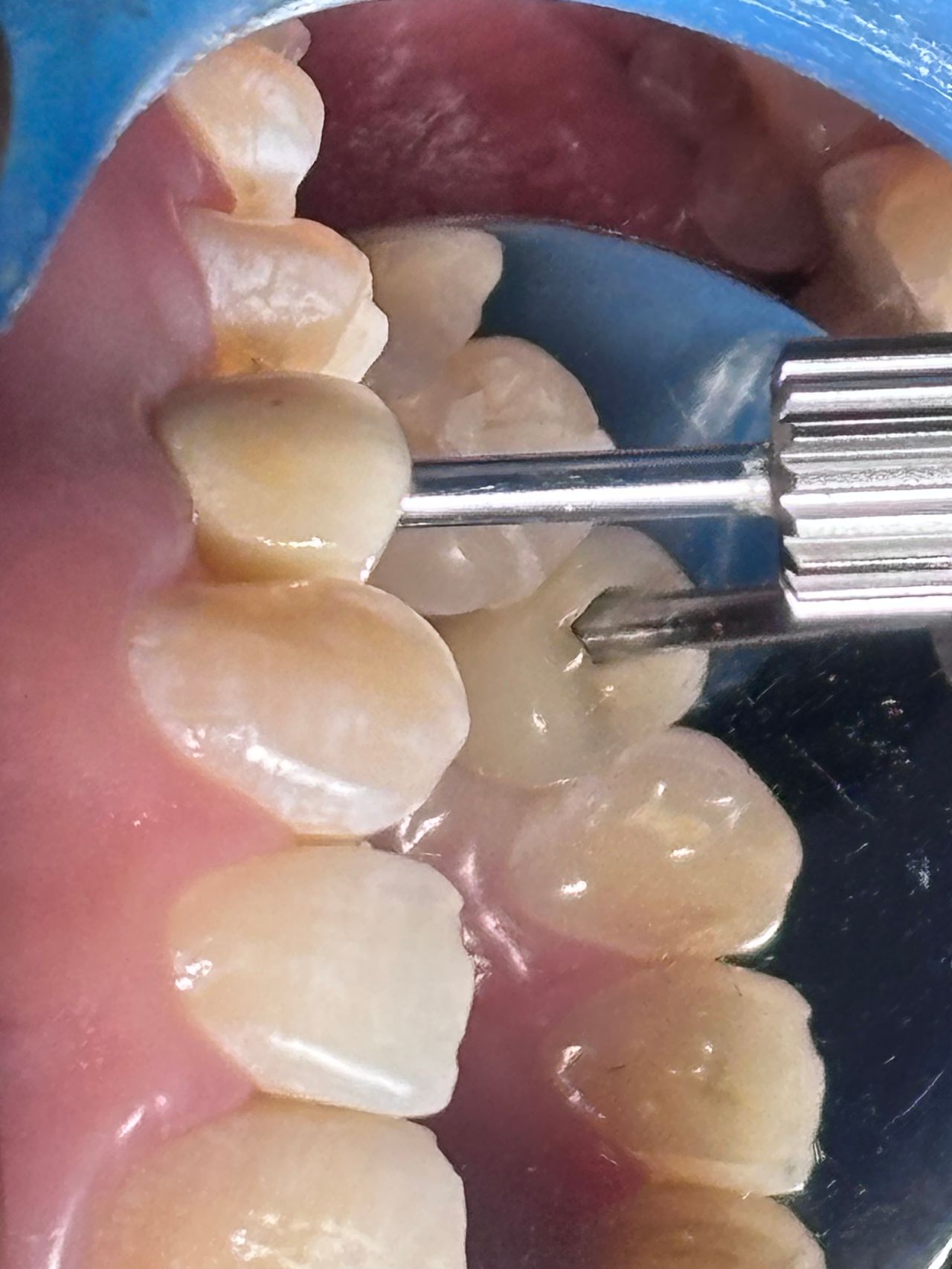 Juan Carlos Estrada Angeles-16