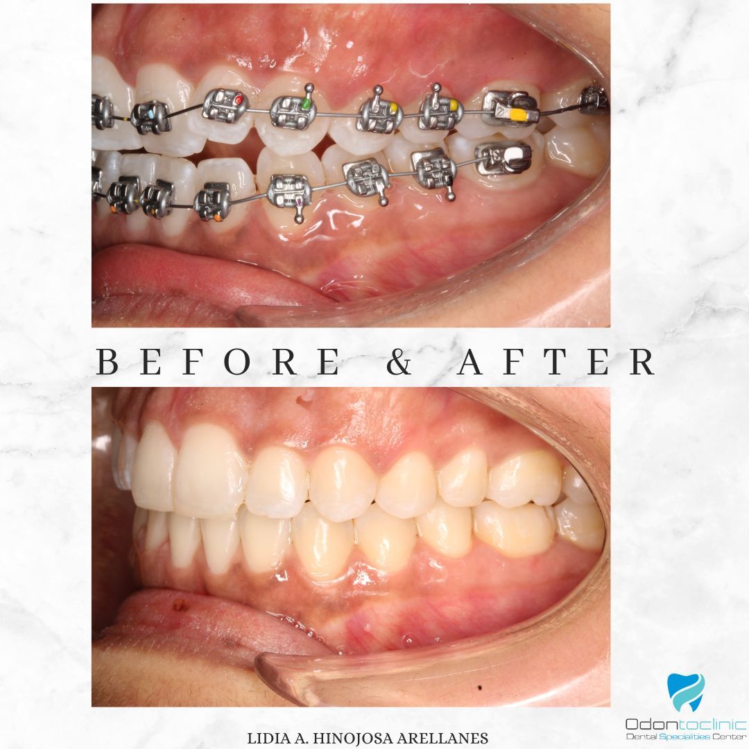 Lidia Abigail Hinojosa Arellanes-37