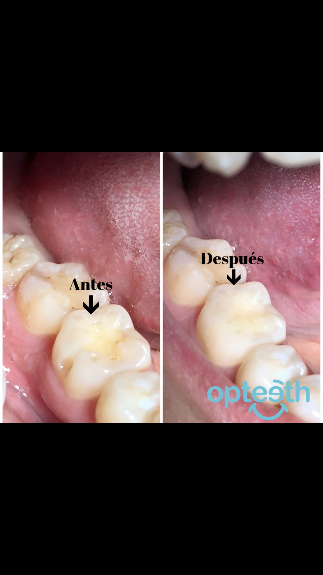 Zuriel Ayala Garcia-19