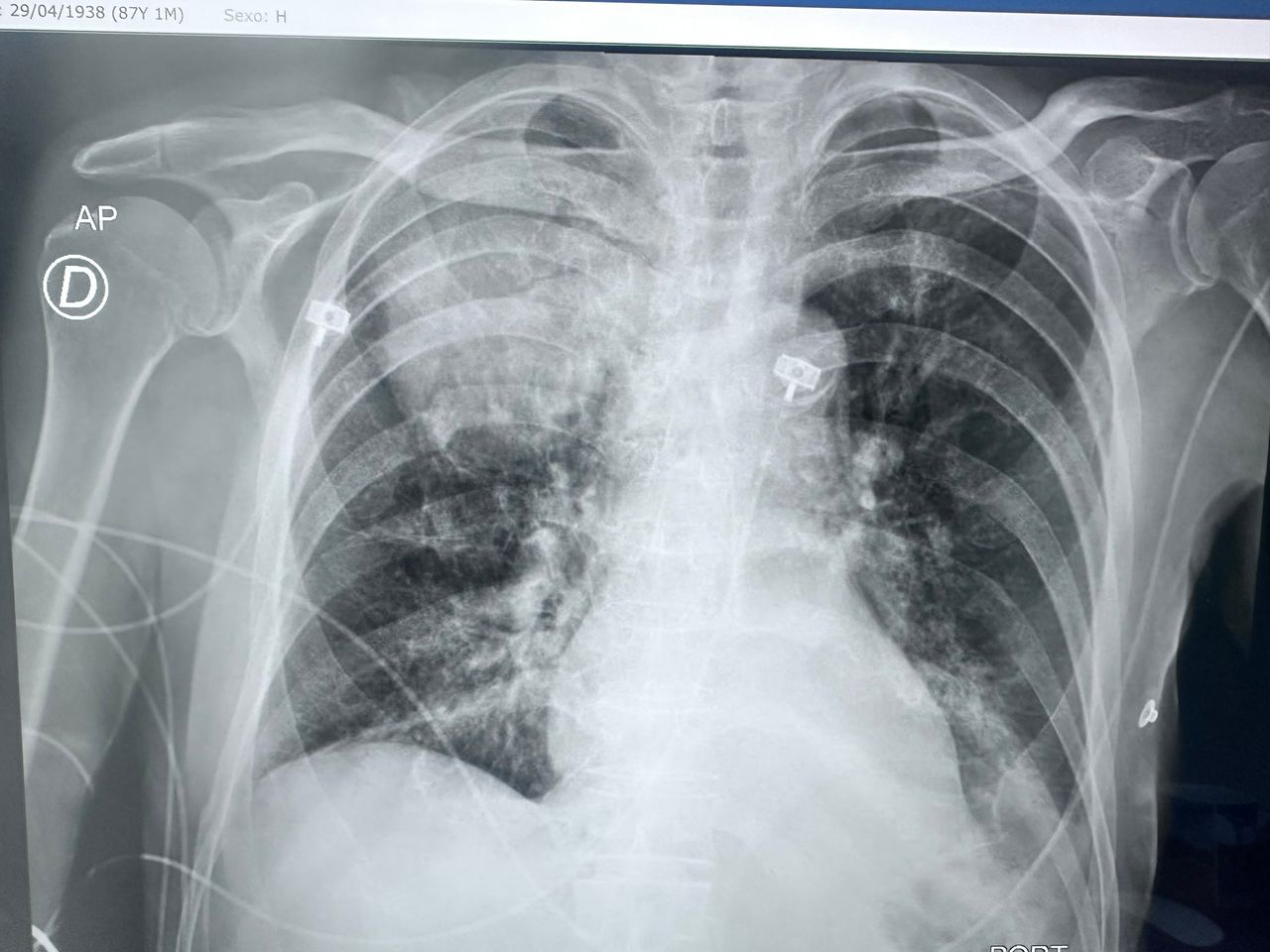 Jose Ivan Juarez Ramirez-9