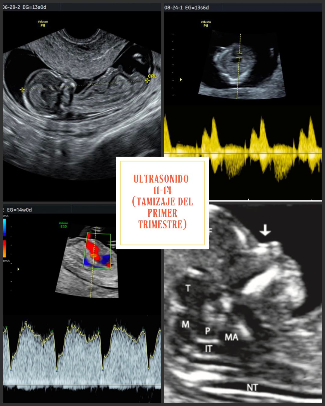 Carlos Arturo Martínez Méndez-11