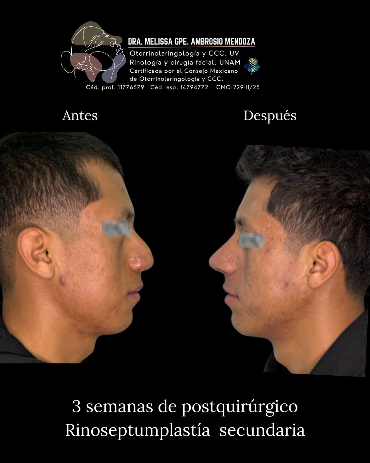 Melissa Guadalupe Ambrosio Mendoza-8