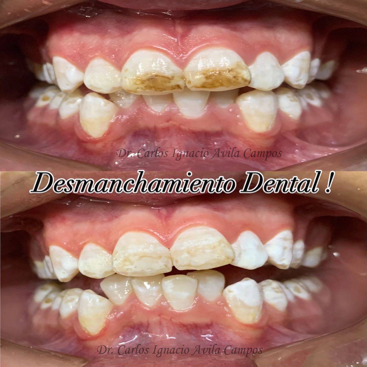 Carlos Ignacio Avila Campos-9