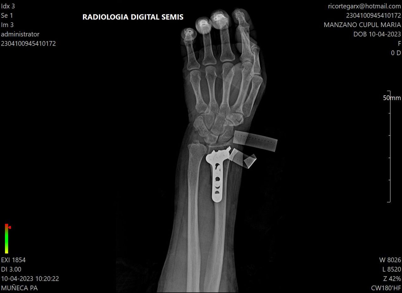 Carlos Humberto Vera Torres-8