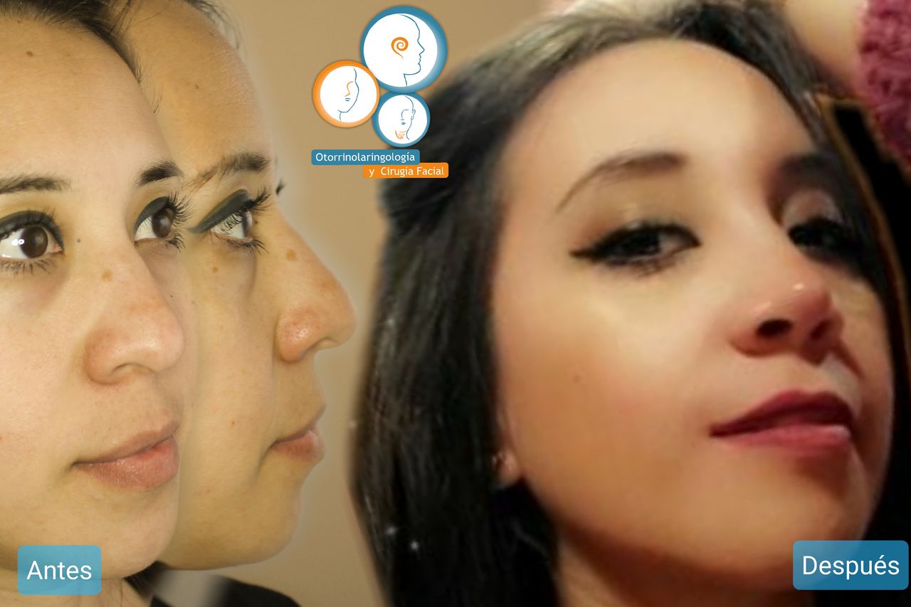 José Christian Ávila Romero-9