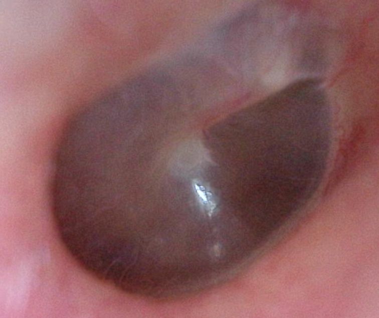 Eva María Herrera Baltazar-17