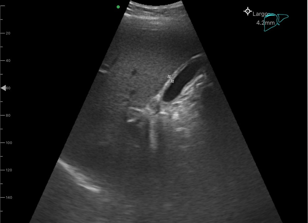 Juanita Pérez Escobar-6