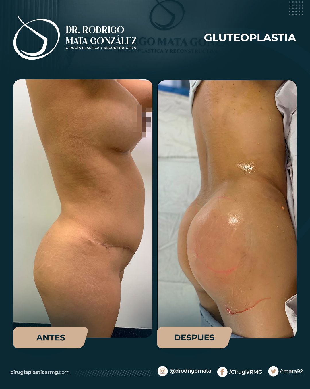 Rodrigo Mata Gonzalez-12