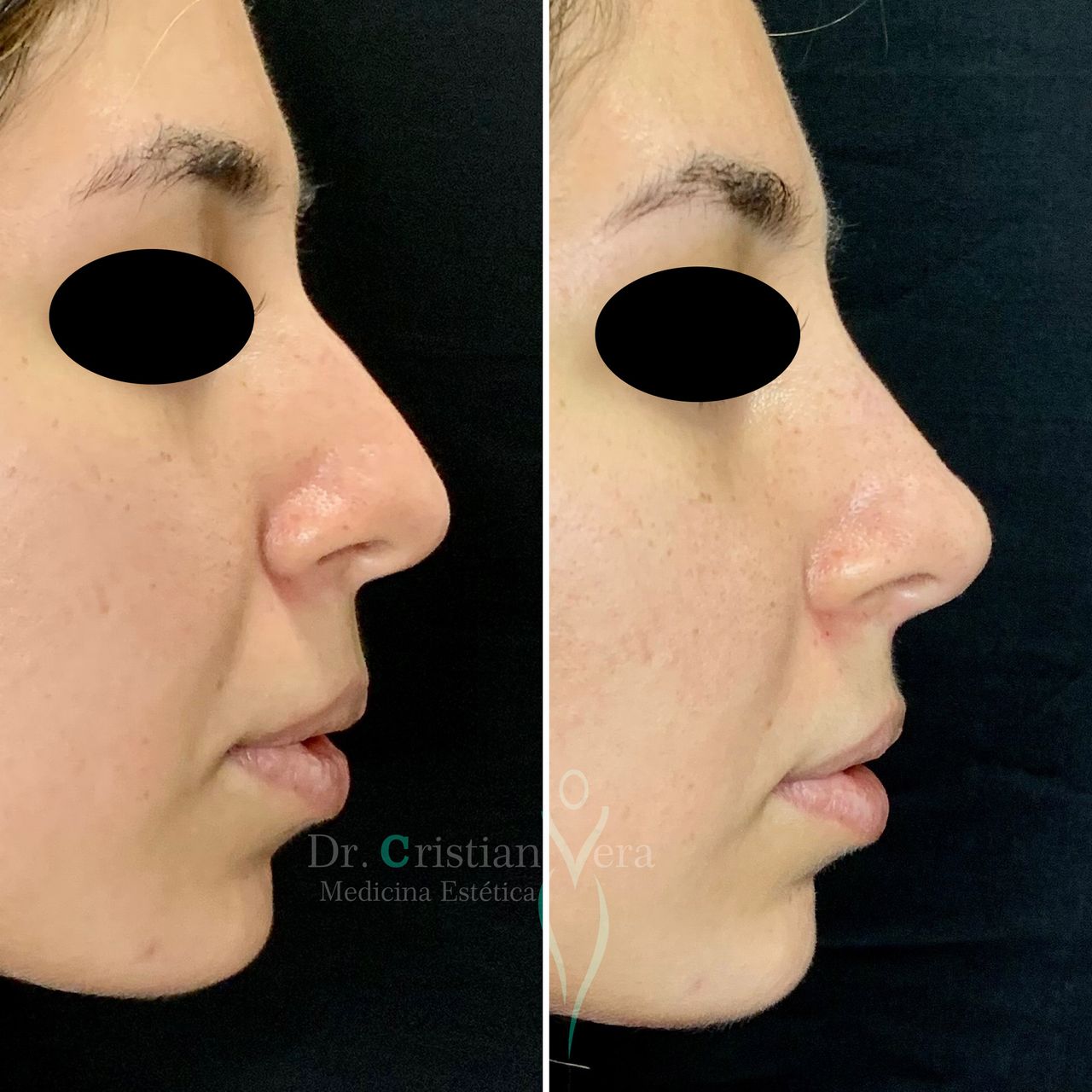 Cristian Eduardo Vera Nuño-13