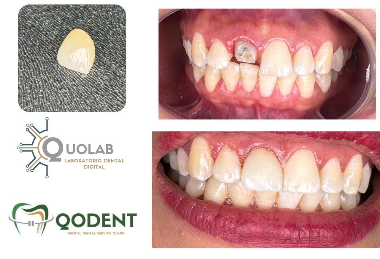 José Luis Quintero-0