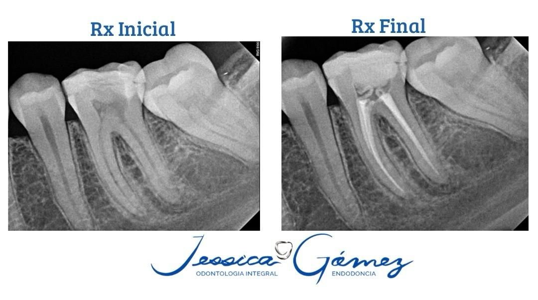 Jessica Gómez Tavizon-9