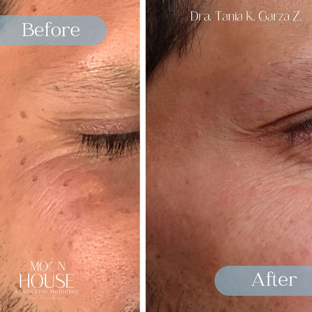 Tania Karine Garza Zepeda-20