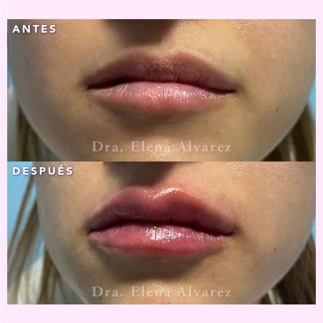 Elena Alvarez Velazquez-20