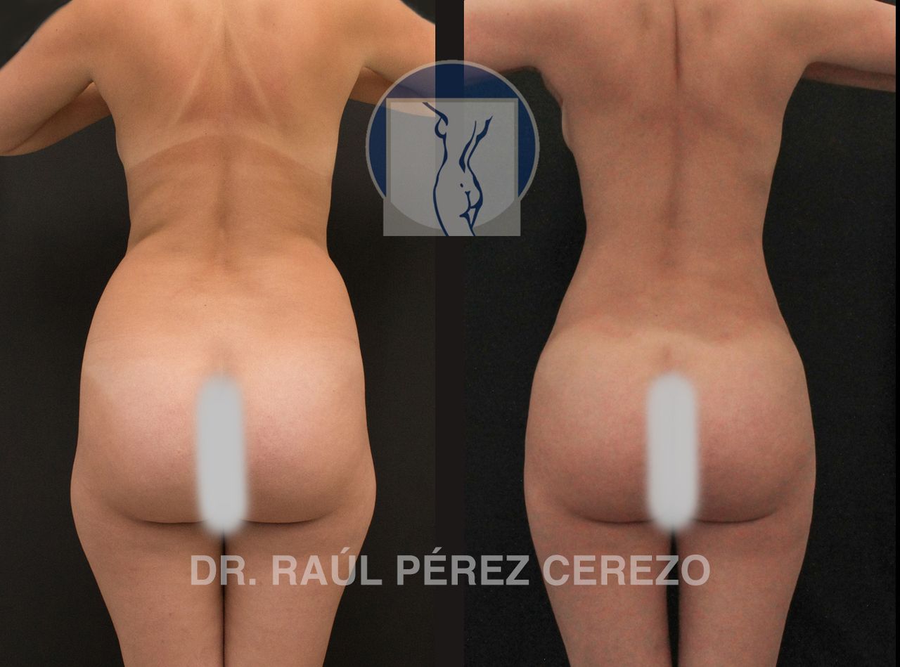 Raúl Pérez Cerezo-32