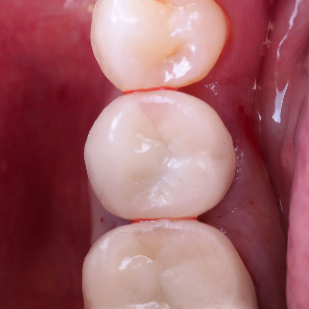 Hugo Enrique Aguilar Lamas-139