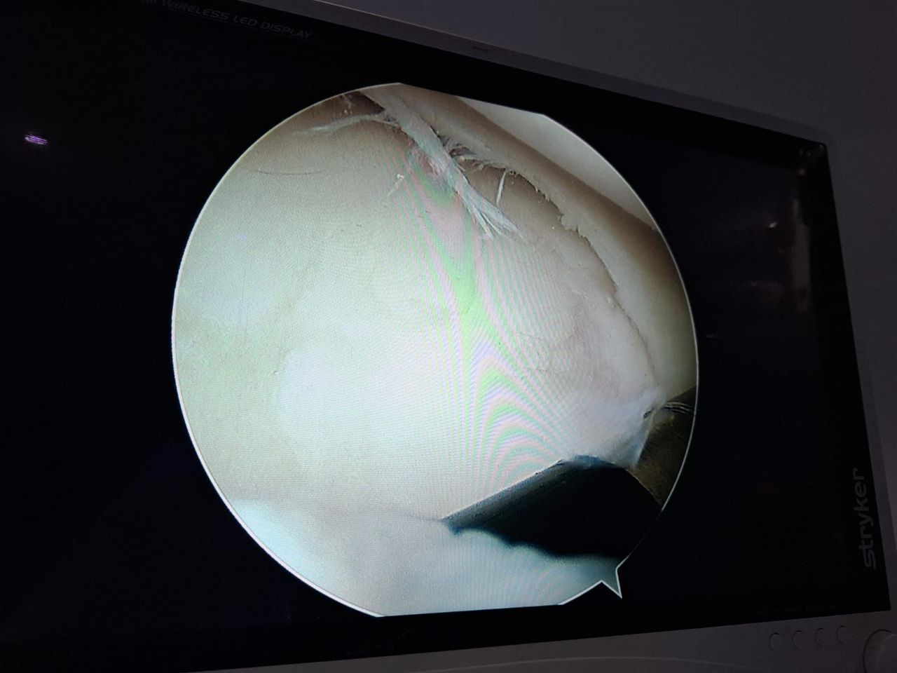 Edwin Acosta Martinez-3