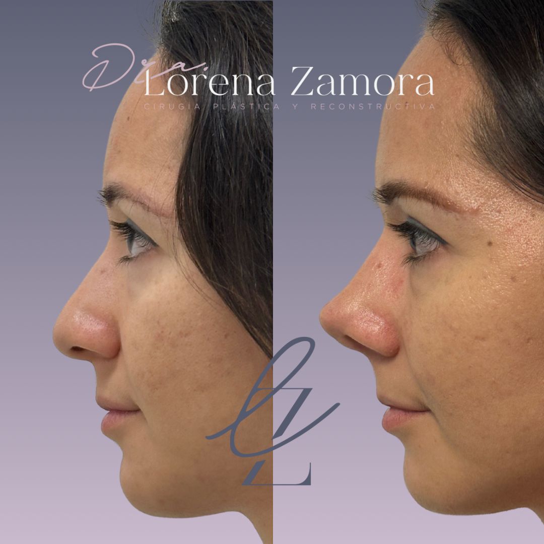 Lorena Zamora Pérez-2