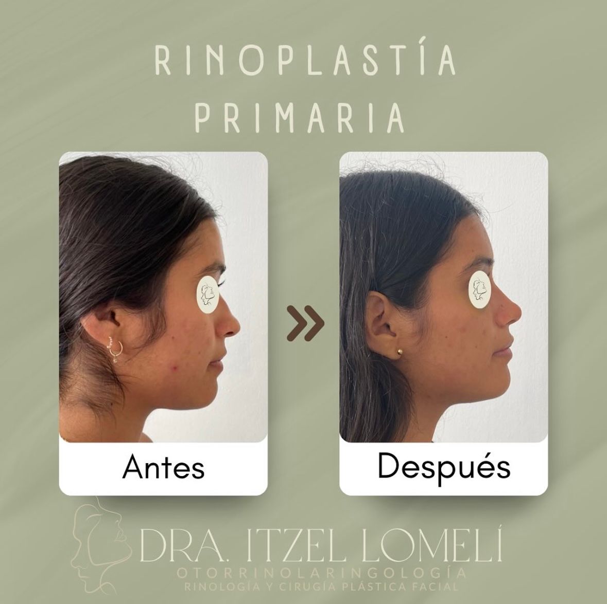 Itzel A Lomelí Gonzalez-4