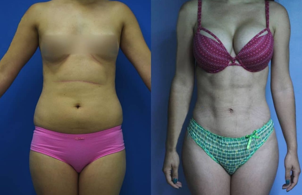 Giuseppe Tanzillo-32