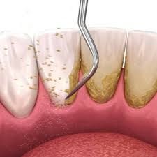 Diana Gabriela Aguilar Gutiérrez-1