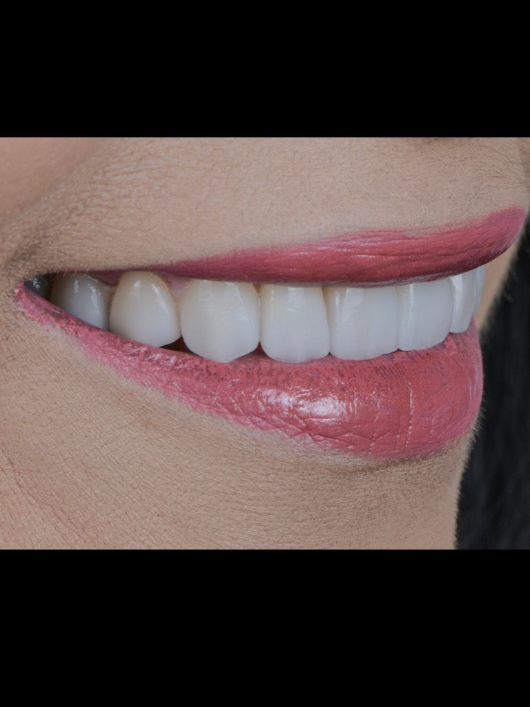 Ricardo López Lemus-98