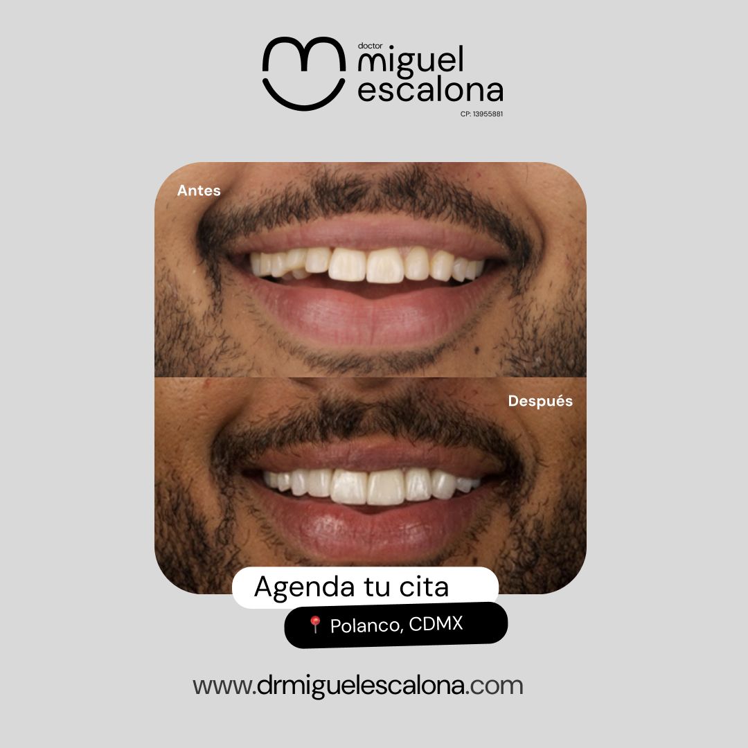 Miguel Alberto Escalona Mora-7