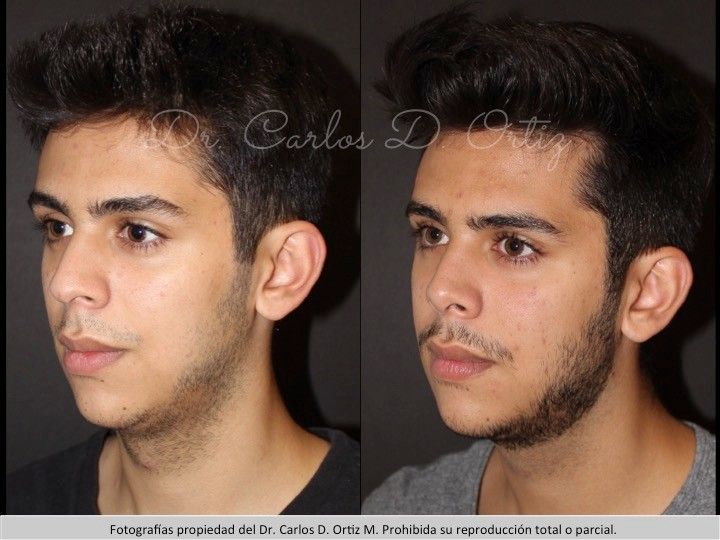 Carlos David Ortiz Moreno-14