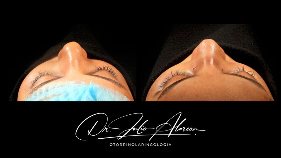 Julio César Alarcón Ortiz-4