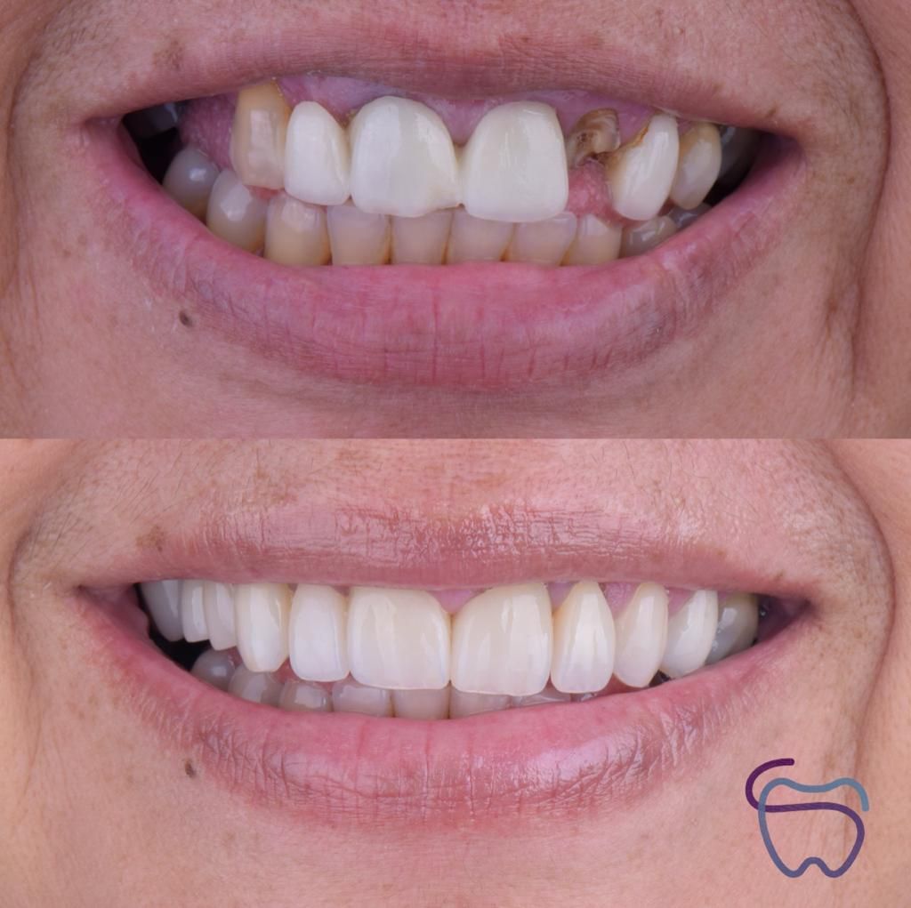 Pilar Fernández Guzmán-2