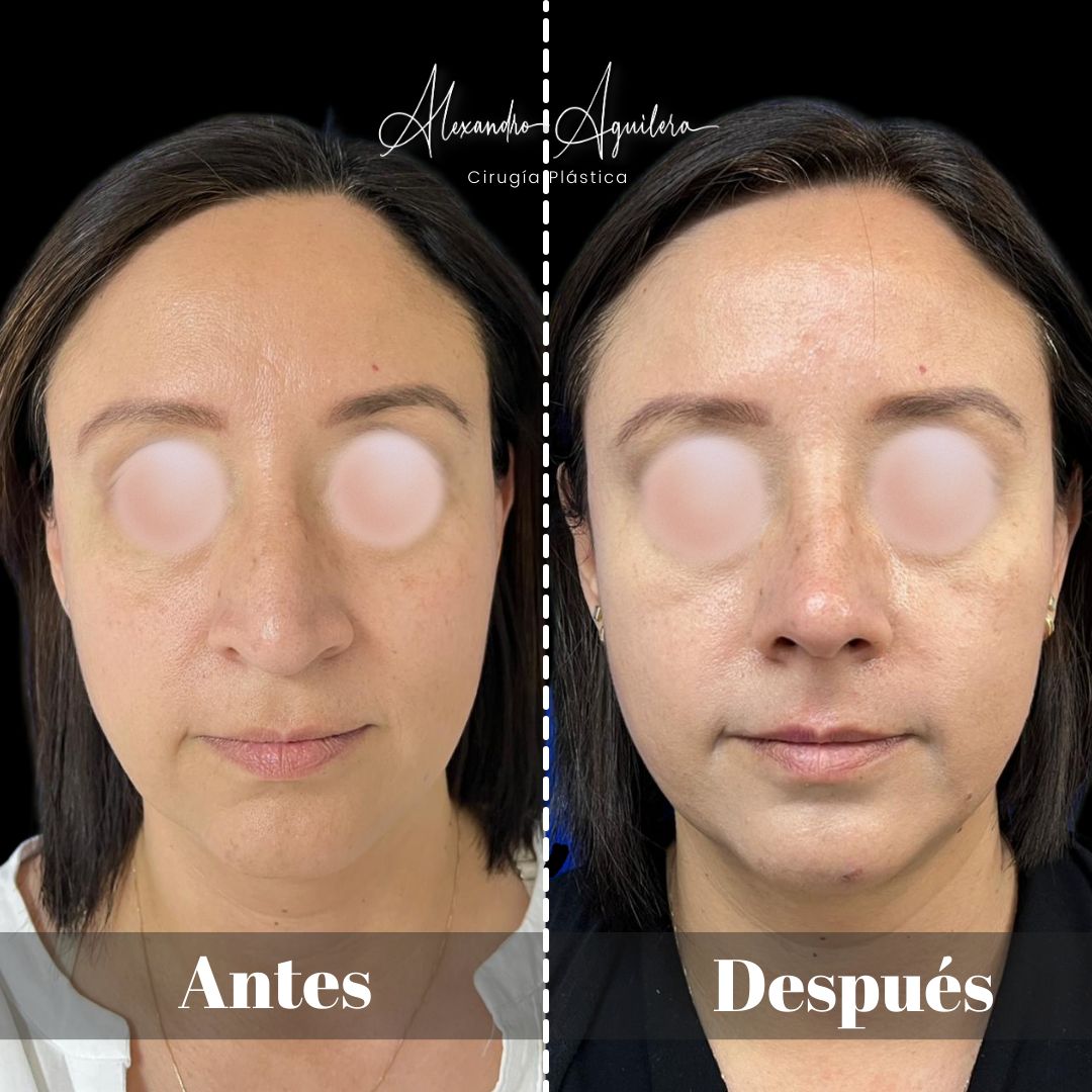 Alexandro Aguilera Salgado-46