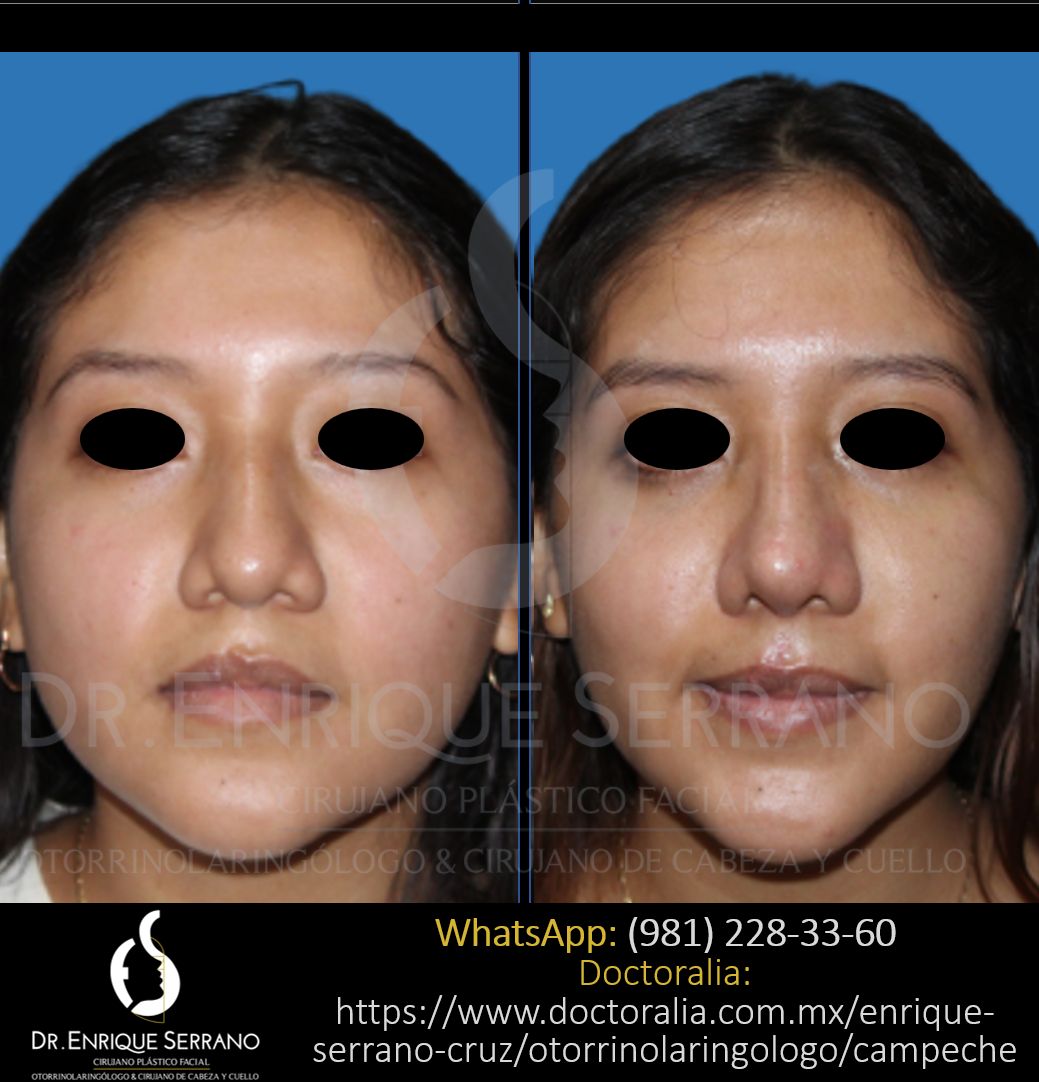 Enrique Serrano Cruz-43