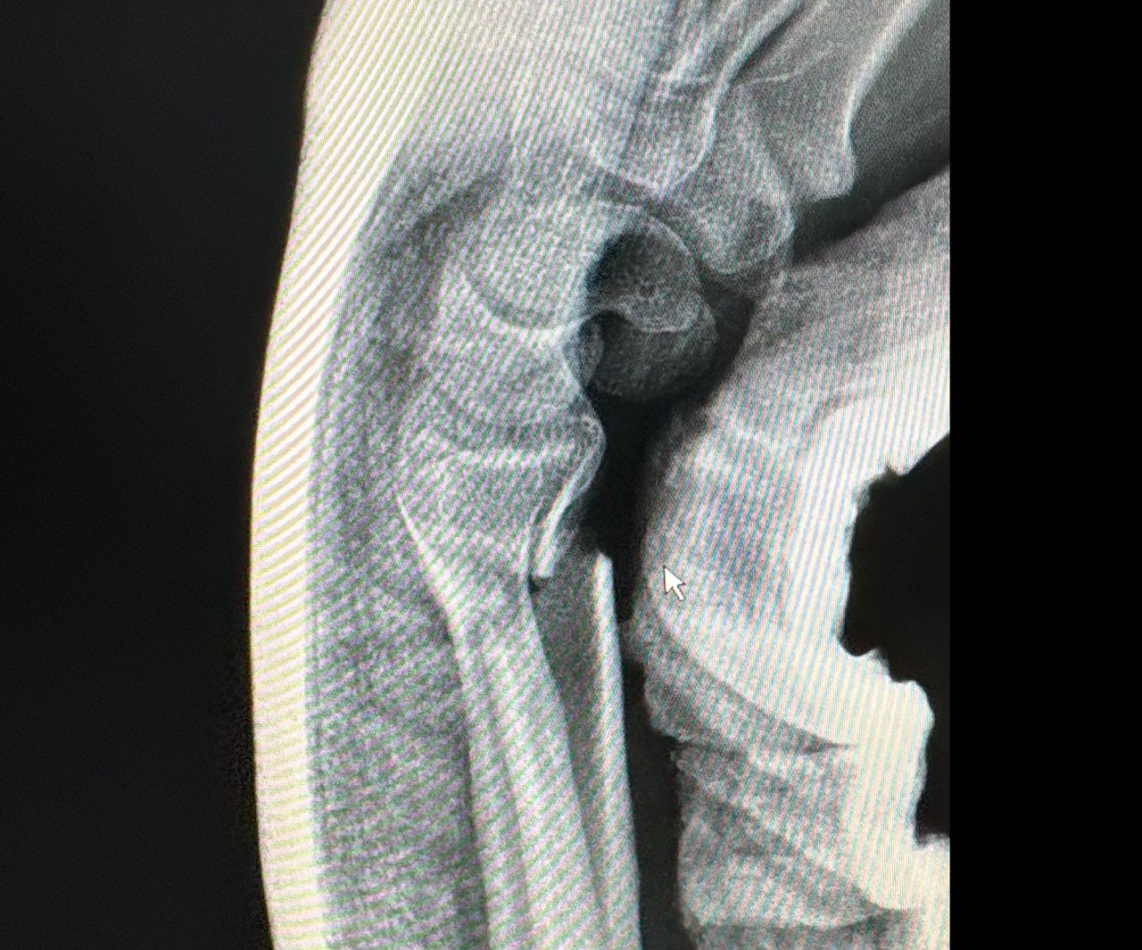 Max Georges Sainte Bernal-7