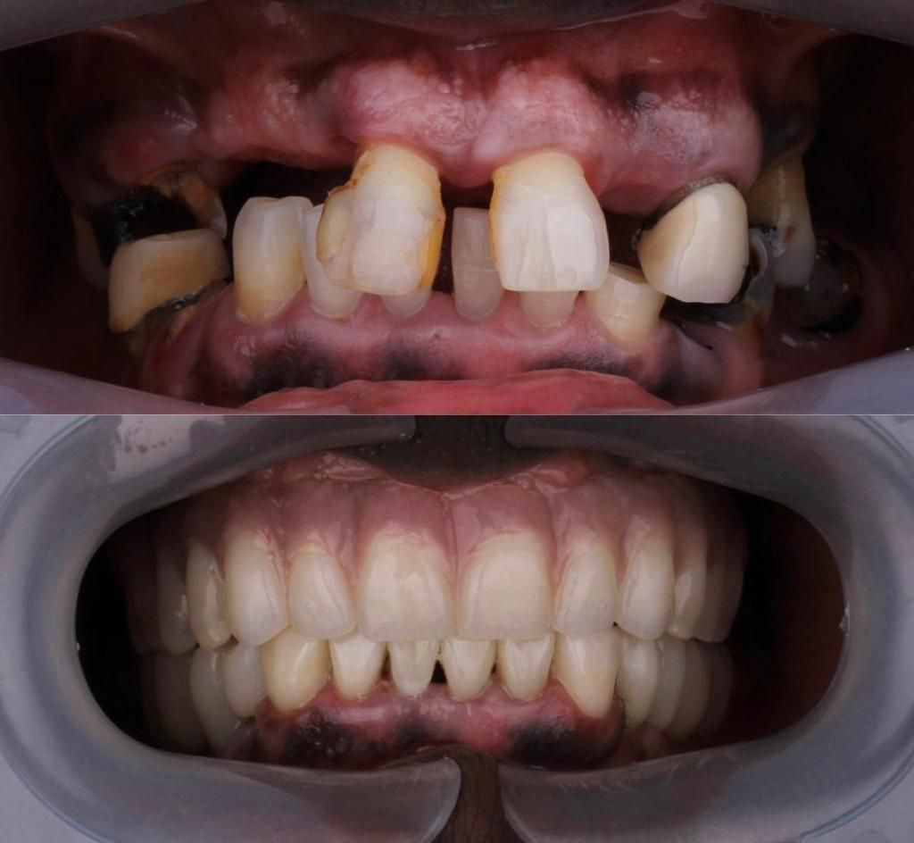 Josué Márquez Gómez-115