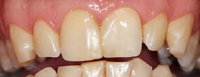 Esmeralda Candida Guerrero Pimentel-12