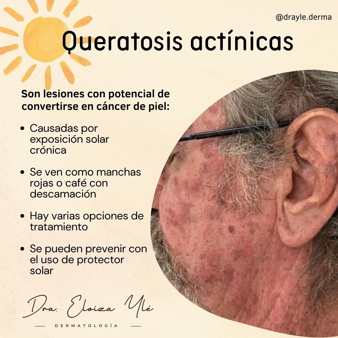 Eloiza Lizeth Ylé Arámburo-3